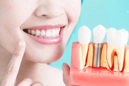 Клиника БИЭМ: стоматология протезирование зубов